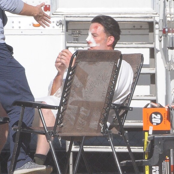 Exclusif - Ben Affleck, le nez cassé sur le tournage de 'Live By Night' à Los Angeles, le 8 décembre 2015.