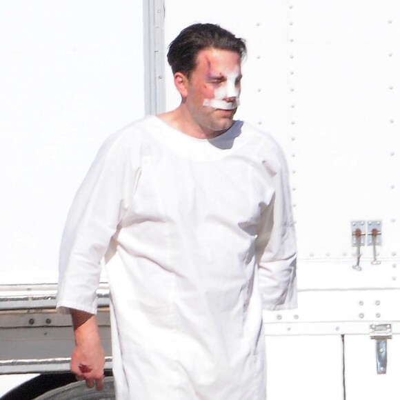 Exclusif - Ben Affleck, le nez cassé sur le tournage de 'Live By Night' à Los Angeles, le 8 décembre 2015.