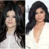 Kylie Jenner avant et après la chirurgie esthétique : à gauche en 2011, à droite en 2016.
