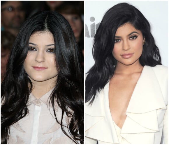 Kylie Jenner avant et après la chirurgie esthétique : à gauche en 2011, à droite en 2016.