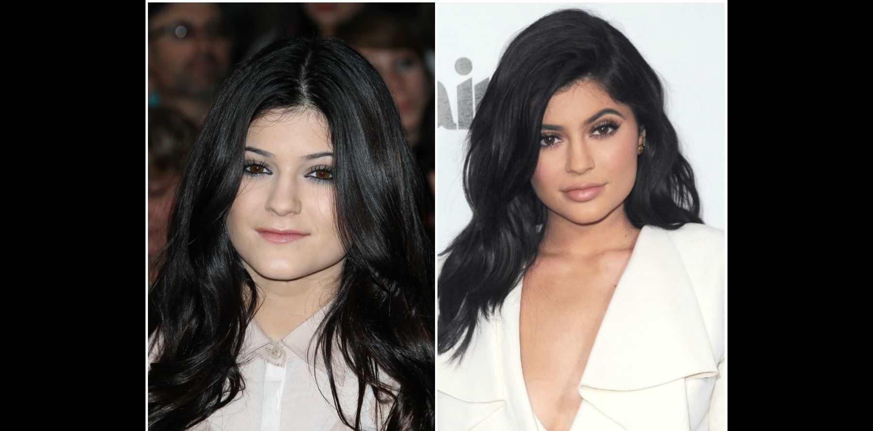 Kim Kardashian Avant Chirurgie Les Anges Kylie Jenner métamorphosée par la chirurgie : Son docteur balance ! -  Purepeople