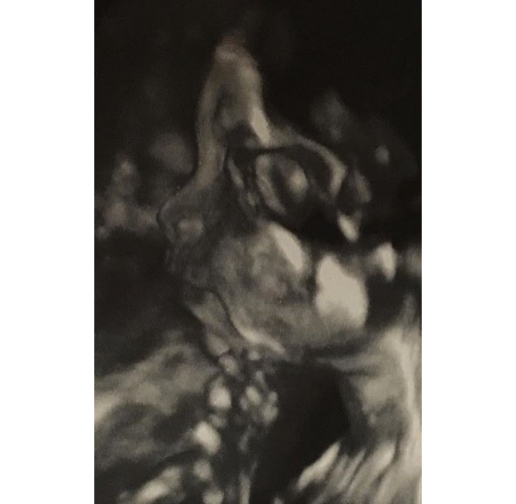 Rob Kardashian dévoile une échographie de sa petite fille, dont la naissance est prévue pour le mois de novembre. Photo publiée sur Instagram le 23 septembre 2016