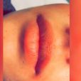 Les lèvres de Coralie Porrovecchio avant sa micro-pigmentation, Snapchat, décembre 2016