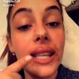 Coralie Porrovecchio se confie sur sa micro-pigmentation des lèvres, Snapchat, décembre 2016