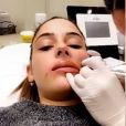 Coralie Porrovecchio opte pour la micro-pigmentation des lèvres, Snapchat, décembre2016