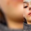 Coralie Porrovecchio en séance de micro-pigmentation des lèvres, Snapchat, décembre 2016