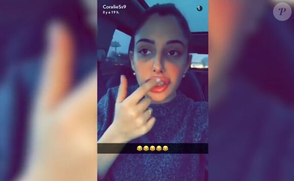 Coralie Porrovecchio les lèvres gonflées, Snapchat, décembre 2016