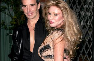 Jocelyn Wildenstein Incroyable La Femme Chat A Retrouve Un Visage Normal Purepeople