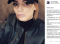 Nadège Lacroix, victime d'une chirurgie ratée ? Son nouveau nez dézingué...