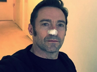 Hugh Jackman : Sixième tumeur cancéreuse et nouvelle opération chirurgicale