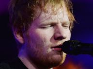 Ed Sheeran : D'où vient sa cicatrice sur le visage ?