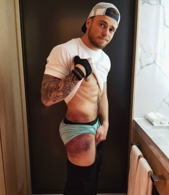 Gus Kenworthy dévoile ses blessures sur Instagram. Février 2018