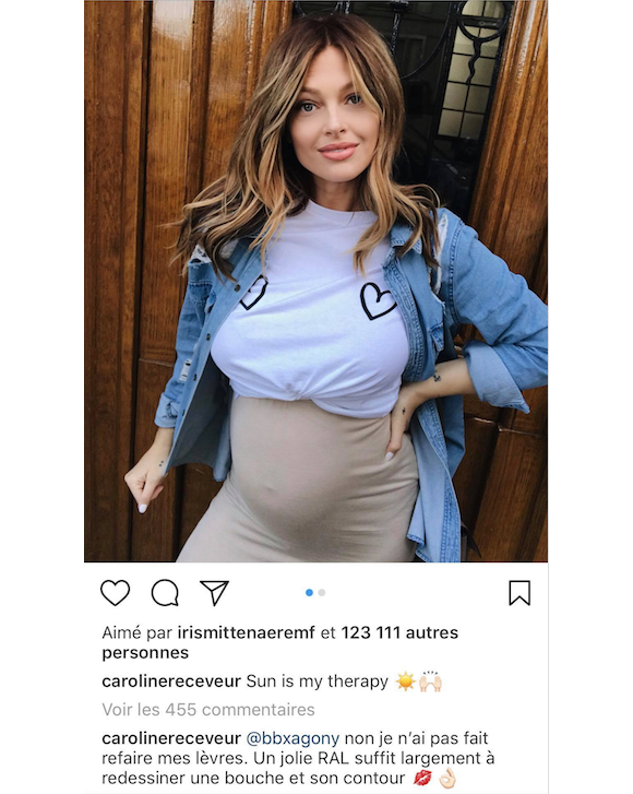 Caroline Receveur enceinte le 17 avril 2018. Non, elle n'a pas fait refaire ses lèvres !