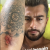Jesta et Benoît (Koh-Lanta) blessés après un accident de scooter survenu lors du tournage de "La Villa : La Bataille des couples" (TFX) en juin 2018 en République dominicaine.