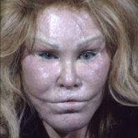 Jocelyn Wildenstein : La femme chat a égaré 250 000 dollars de bijoux !