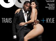 Kylie Jenner : Révélation sur sa grosse cicatrice à la jambe