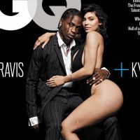 Kylie Jenner : Révélation sur sa grosse cicatrice à la jambe