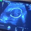 Shay Mitchell est enceinte ! Elle dévoile les premières images de la série qui va suivre sa grossesse Presque Prête. Juin 2019.