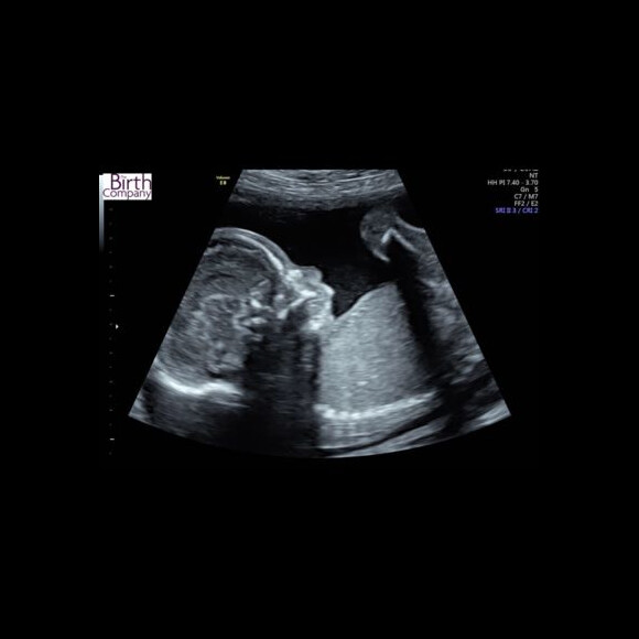 Thomas Vergara, l'amoureux de Nabilla, dévoile les images de leur bébé, le 15 juillet 2019 sur Snapchat.