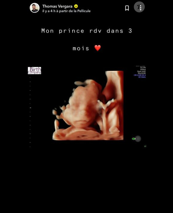 Thomas Vergara, l'amoureux de Nabilla, dévoile les images de leur bébé, le 15 juillet 2019 sur Snapchat.
