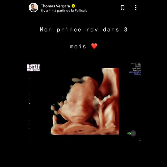 Thomas Vergara, l'amoureux de Nabilla, dévoile les images de leur bébé, le 15 juillet 2019 sur Snapchat.