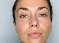 Clio Pajczer au naturel et décomplexée : elle assume sa "peau moins lisse"