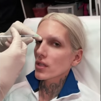 Jeffree Star, premières injections : "Mettre en quarantaine ces p*tain de rides"