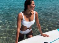 Iris Mittenaere : Couverte de bleus, elle raconte son accident en Corse
