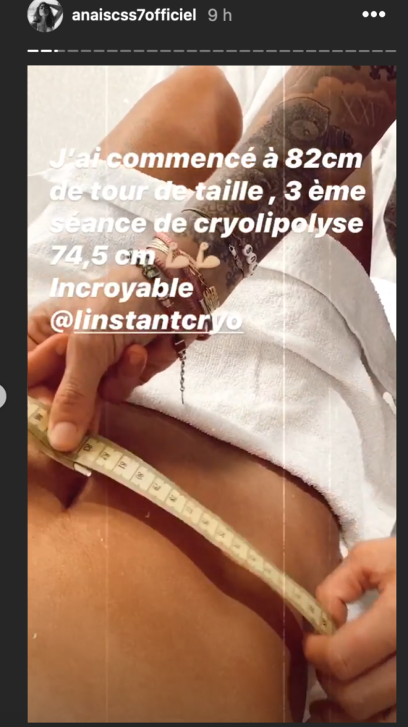 Anaïs Camizuli dévoile le résultat de sa dernière séance de cryolipolyse au ventre - Instagram, 20 juillet 2020
