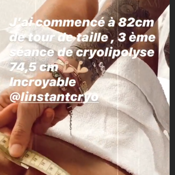 Anaïs Camizuli dévoile le résultat de sa dernière séance de cryolipolyse au ventre - Instagram, 20 juillet 2020