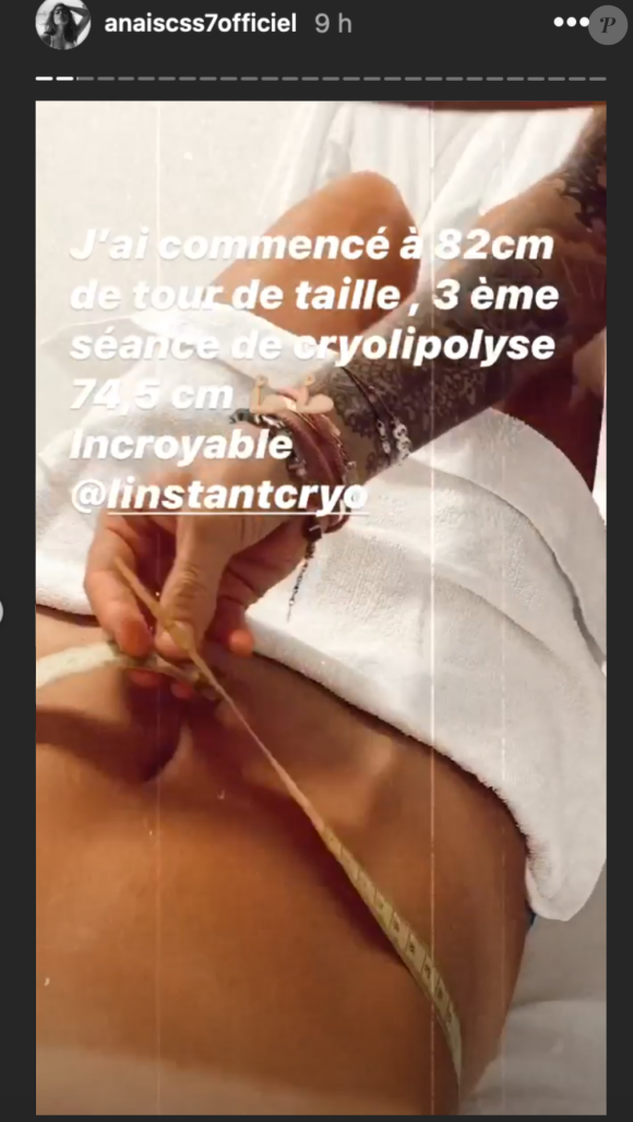 Anaïs Camizuli dévoile le résultat de sa dernière séance de cryolipolyse au ventre - Instagram, 20 juillet 2020