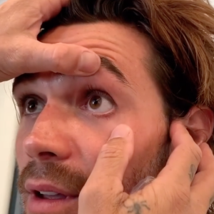KJ Apa se fait retirer un éclat de métal de son oeil gauche. Juillet 2020.