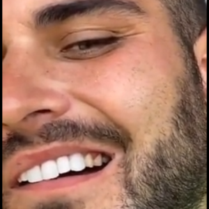 Nikola Lozina révèle s'être blessé sur le tournage des Marseillais vs Le Reste du monde - Snapchat, 28 juillet 2020