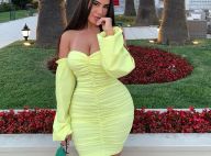 Milla Jasmine souffrante après une rhinoplastie, elle raconte son calvaire