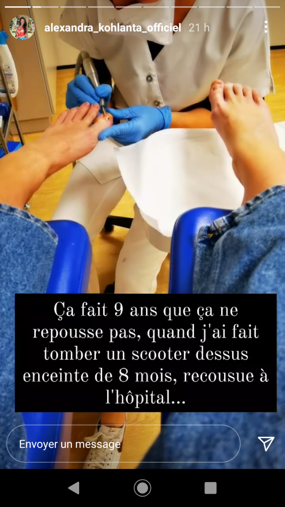 Alexandra de "Koh-Lanta 2020" fait une révélation sur ses ongles en story Instagram, le 10 janvier 2021