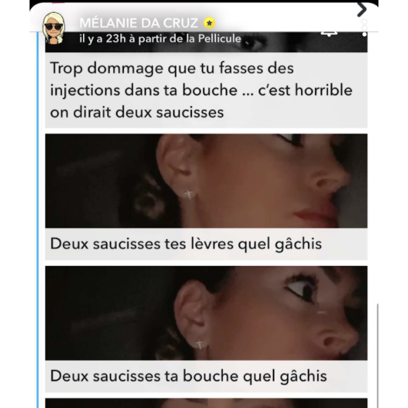 Mélanie Da Cruz dévoile le résultat de ses injections aux lèvres sur Snapchat et répond aux critiques