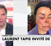 Les visages meurtris de Bernard Tapie et sa femme Dominique après leur agression survenue à leur domicile, en avril 2021.