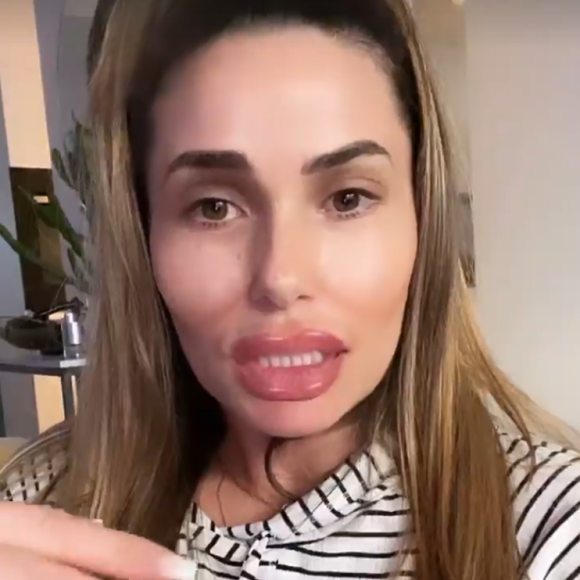 Capucine Anav s'explique sur son apparition avec un visage déformé sur les réseaux sociaux - Instagram