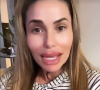 Capucine Anav s'explique sur son apparition avec un visage déformé sur les réseaux sociaux - Instagram