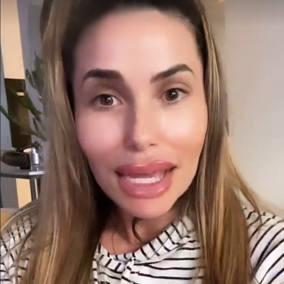 Capucine Anav s'explique sur son apparition avec un visage déformé sur les réseaux sociaux - Instagram