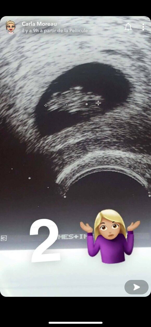 Carla Moreau enceinte : elle dévoile la première échographie sur Snapchat