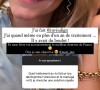 Laure de "Mariés au premeir regard" parle de sa technique pour avoir des dents parfaites