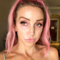 La chanteuse Ashley Monroe révèle souffrir d'un cancer du sang : "J'ai besoin de prières..."