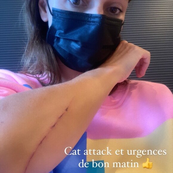 Lolita Séchan raconte sa mésaventure avec son chat Bobby sur Instagram, le 20 juillet 2021.