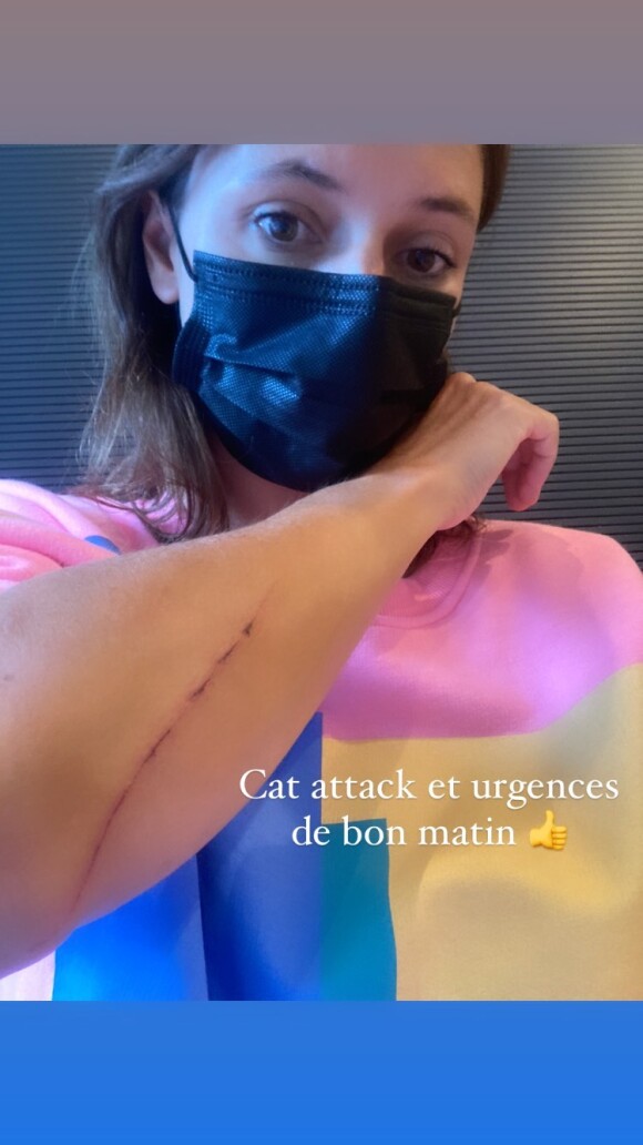 Lolita Séchan après avoir été attaquée par son chat Bobby sur Instagram, juillet 2021.