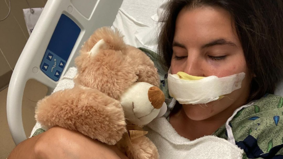 Défigurée par un pitbull, une influenceuse subit une opération et dévoile son visage