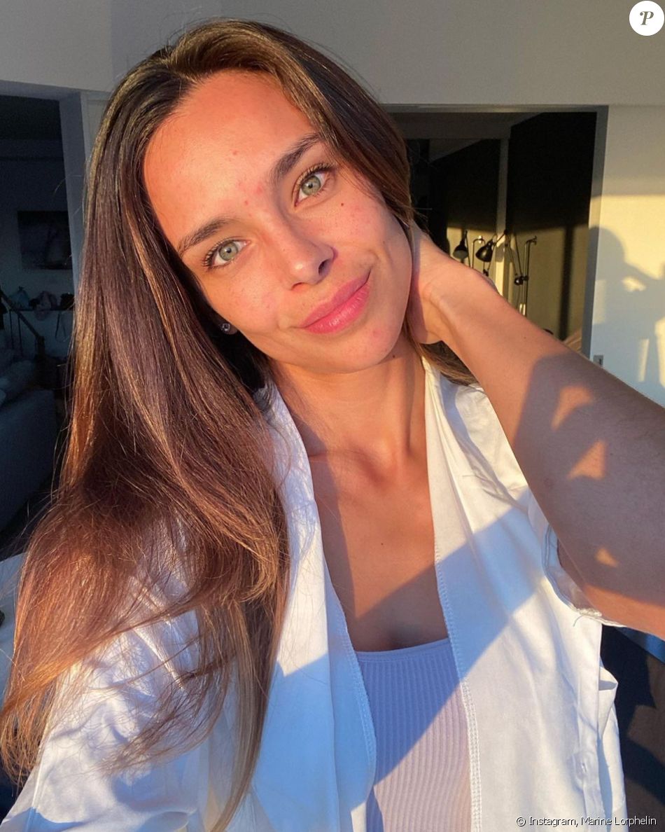 Marine Lorphelin au naturel Décembre Purepeople