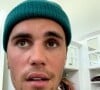 Justin Bieber révèle être paralysé d'une partie de son visage dans une vidéo publiée sur Instagram.