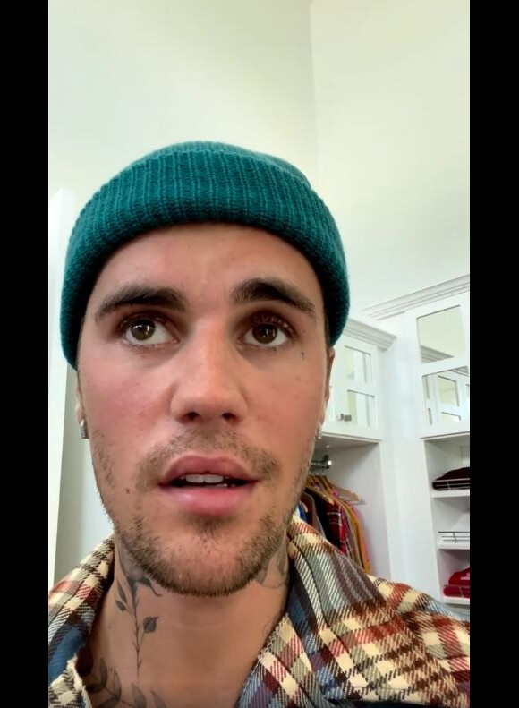 Justin Bieber révèle être paralysé d'une partie de son visage dans une vidéo publiée sur Instagram.