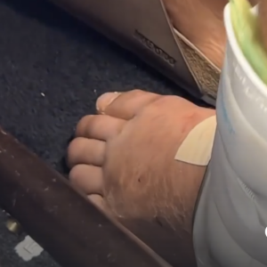 Hillary Vanderosieren partage des images du pied de Giovanni Bonamy juste après son accident de voiture - Instagram